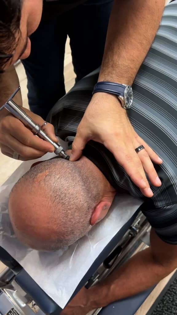 torque release technique