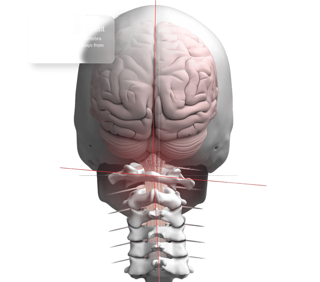 white skull